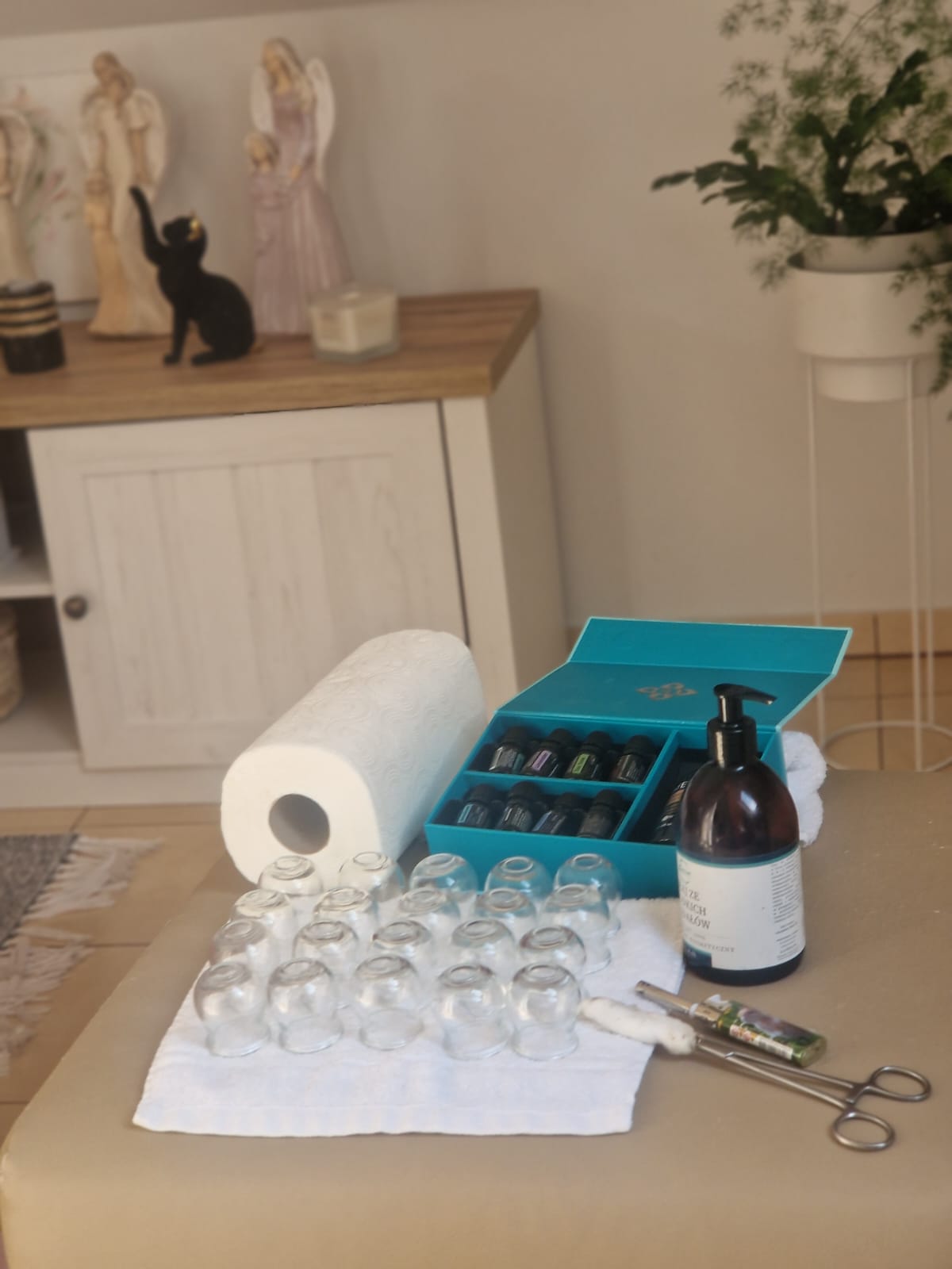 Bańki masażowe cupping – terapia w gabinecie Moc Dotyku